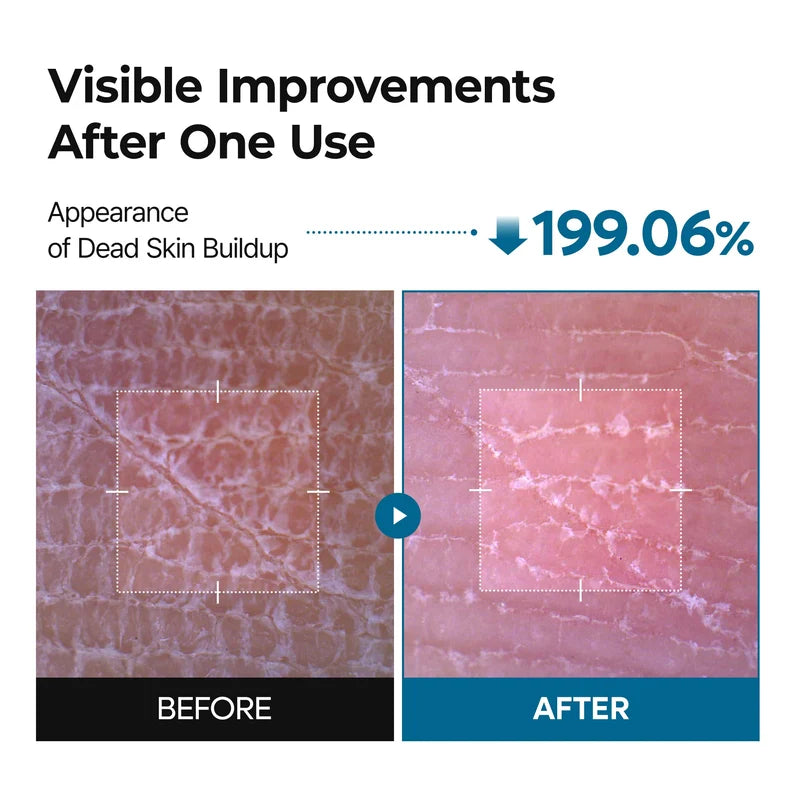 Radiant Blowout Routine Set